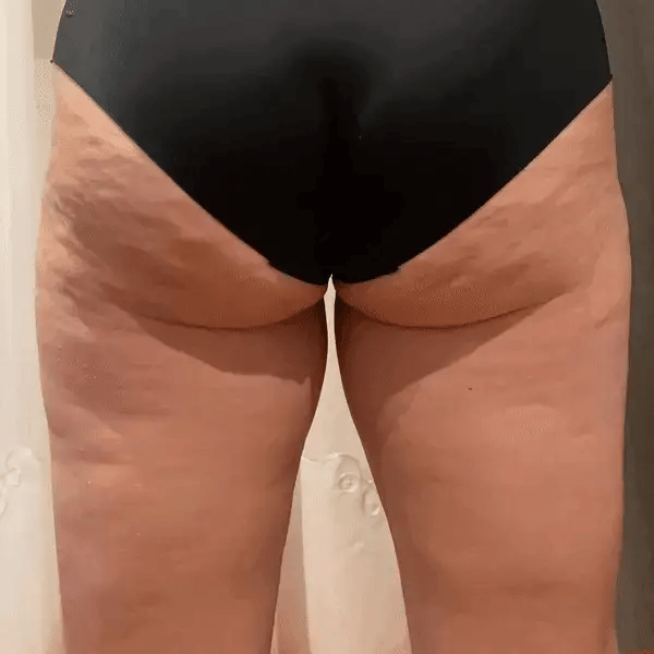 The Spoiled Mama Cheek Chic Cellulite Gel in - Postpartum > cellulite cream gel photo