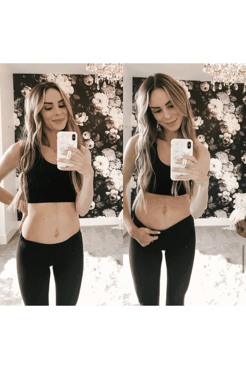 Tummy Butter Postpartum Stretch Mark Cream - SwagglyLife Home & Fashion