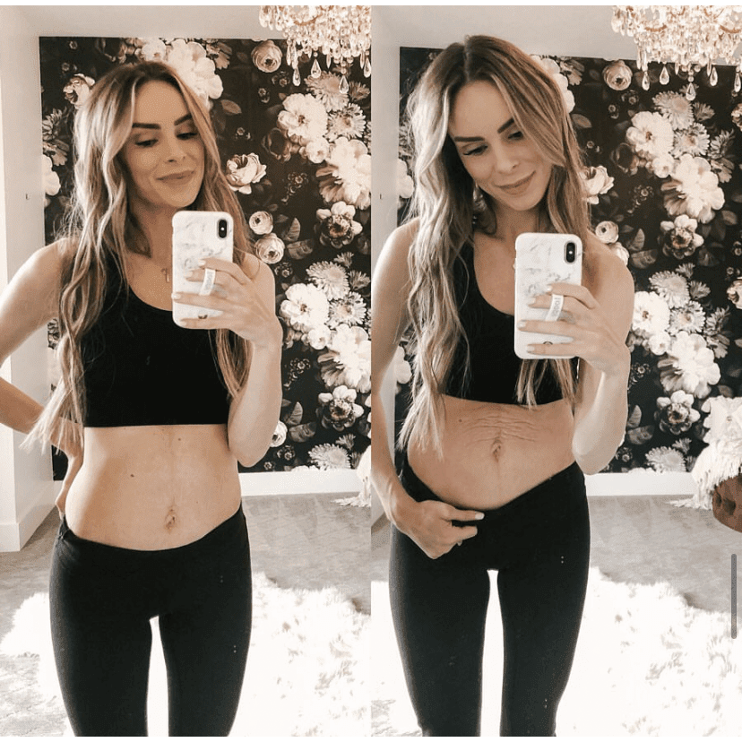 Tummy Butter Post Pregnancy Stretch Mark Cream in - Stretch Mark Lotion > pregnancy stretch marks removal cream > postpartum body care > postpartum skin care > best product for pregnancy stretch marks > post pregnancy skincare > after pregnancy stretch marks removal cream > postpartum belly skin photo