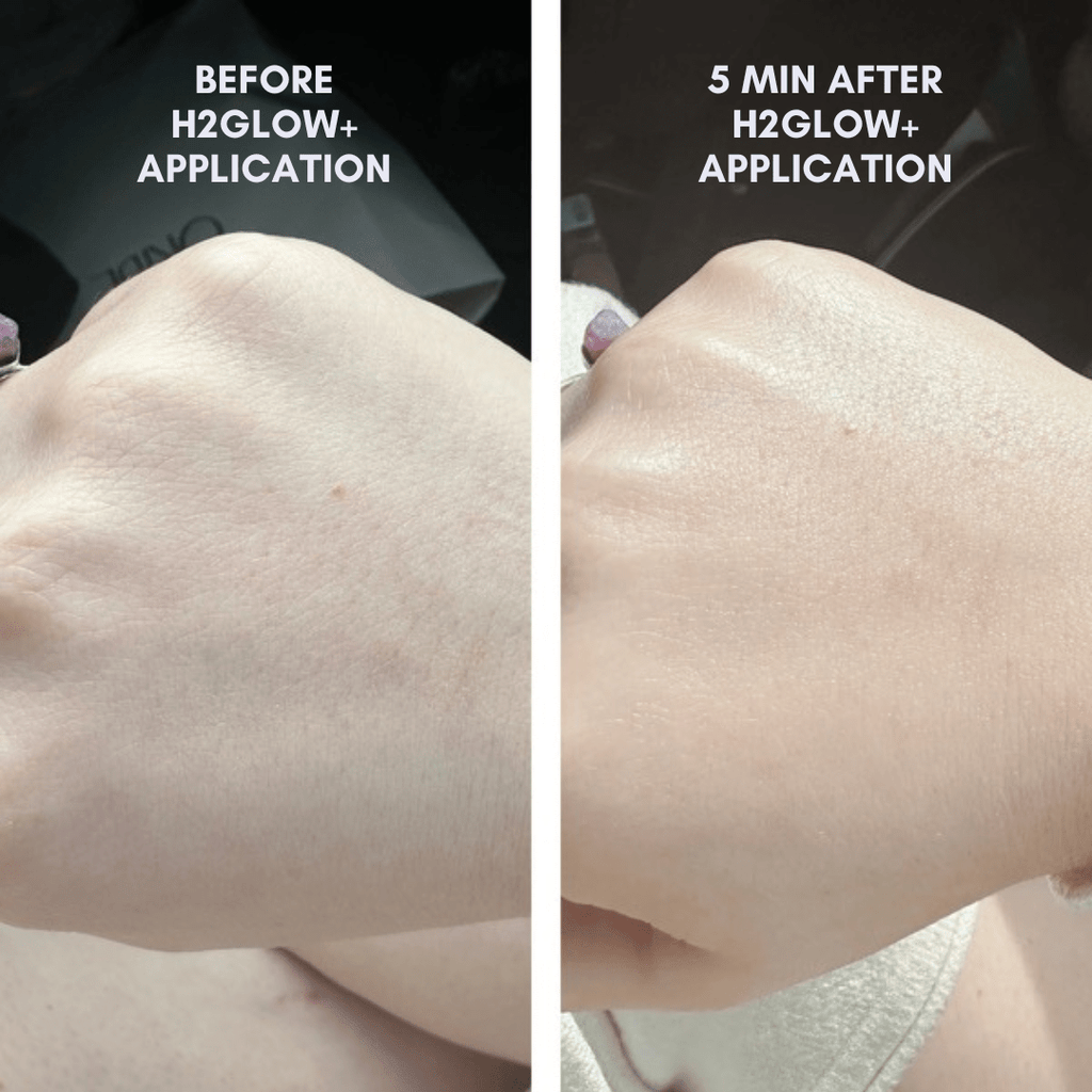 Clover by Clove + Harlow The Juicy Skin Set in - photo