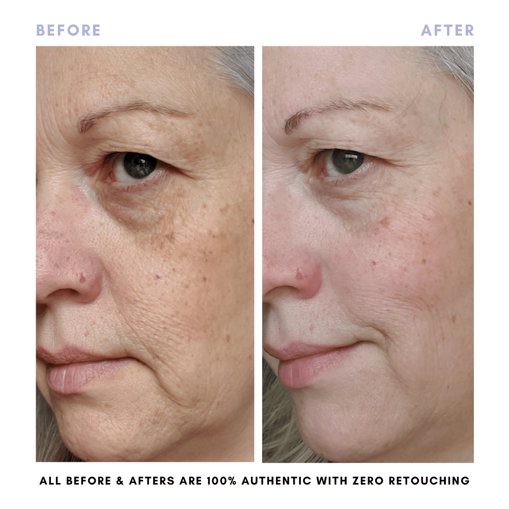 The Skin Reset Starter Kit in - Skincare photo