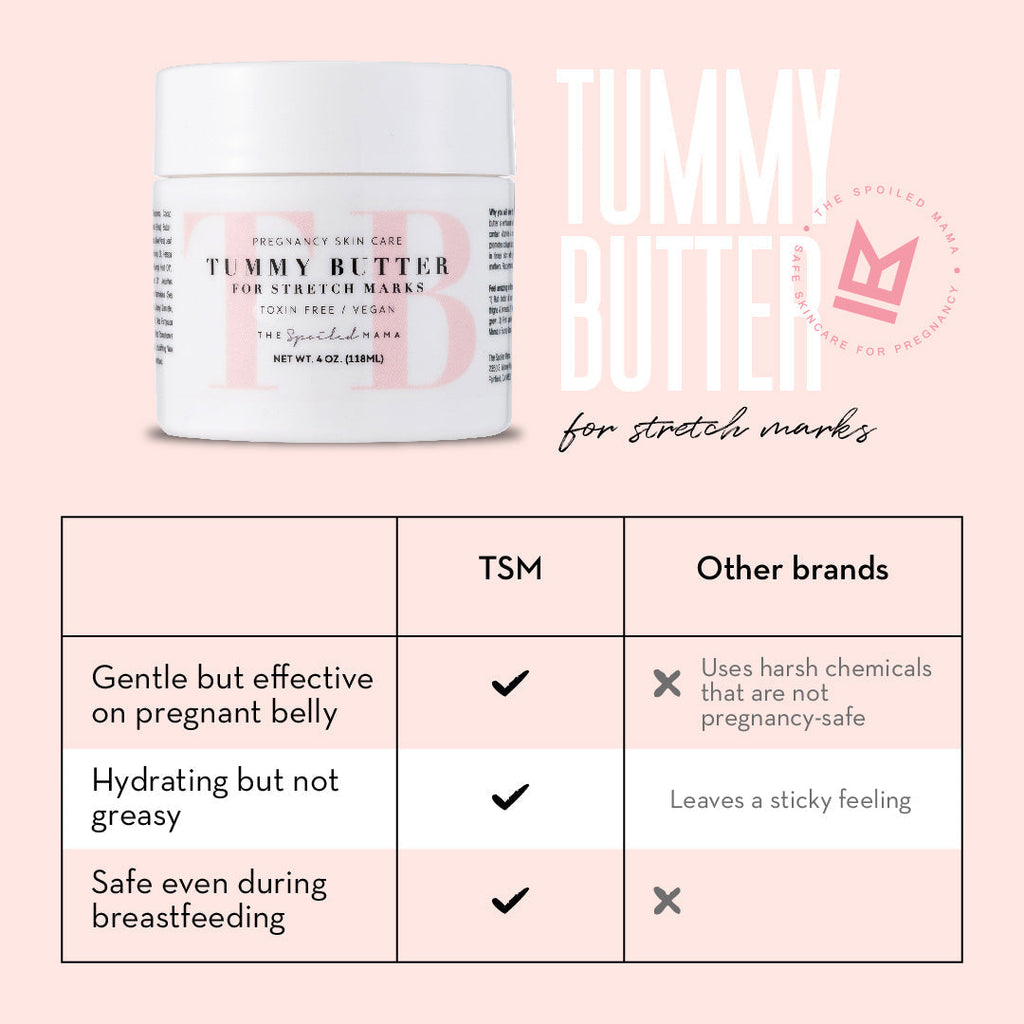 The Spoiled Mama Tummy Butter for Stretch Marks in - Stretch Mark Lotion > belly butter > pregnancy stretch marks removal > tummy butter for stretch marks > pregnancy stretch marks treatment > pregnancy creams to prevent stretch marks photo
