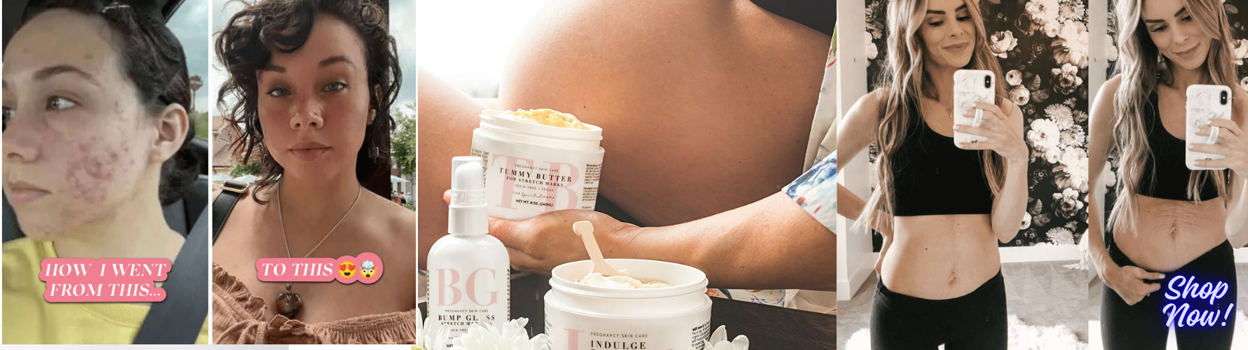 The Spoiled Mama: Luxury Pregnancy Skincare | Swaggylife