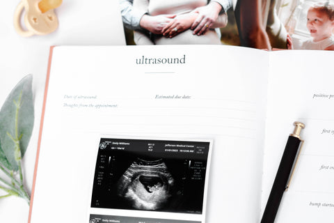 Duncan & Stone Paper Co. Pregnancy Journal in - Journal photo