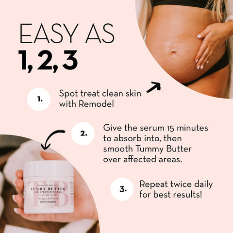 ReModel Serum: Say Goodbye to Stretch Marks in - Serum > pregnancy stretch marks removal cream > postpartum body care > postpartum skin care > best product for pregnancy stretch marks > post pregnancy skin care > after pregnancy stretch marks removal cream photo