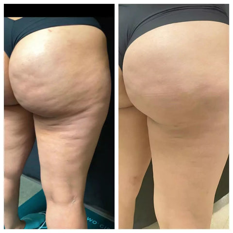 The Spoiled Mama Cheek Chic Cellulite Gel in - Postpartum > cellulite cream gel photo