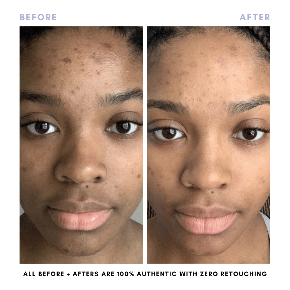 Balancing Oil in - Skincare photo