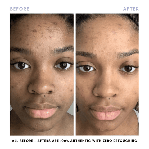 Balancing Oil in - Skincare photo