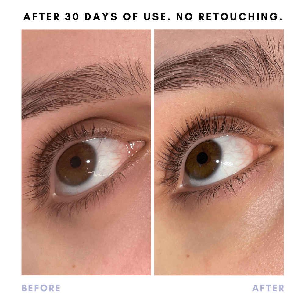 Full Of It Hair Growth Serum in - Skincare photo