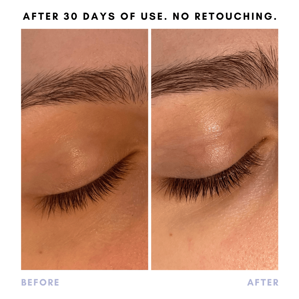 Full Of It Hair Growth Serum in - Skincare photo