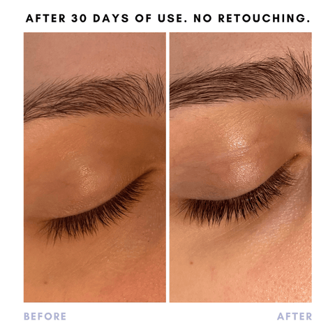 Full Of It Hair Growth Serum in - Skincare photo