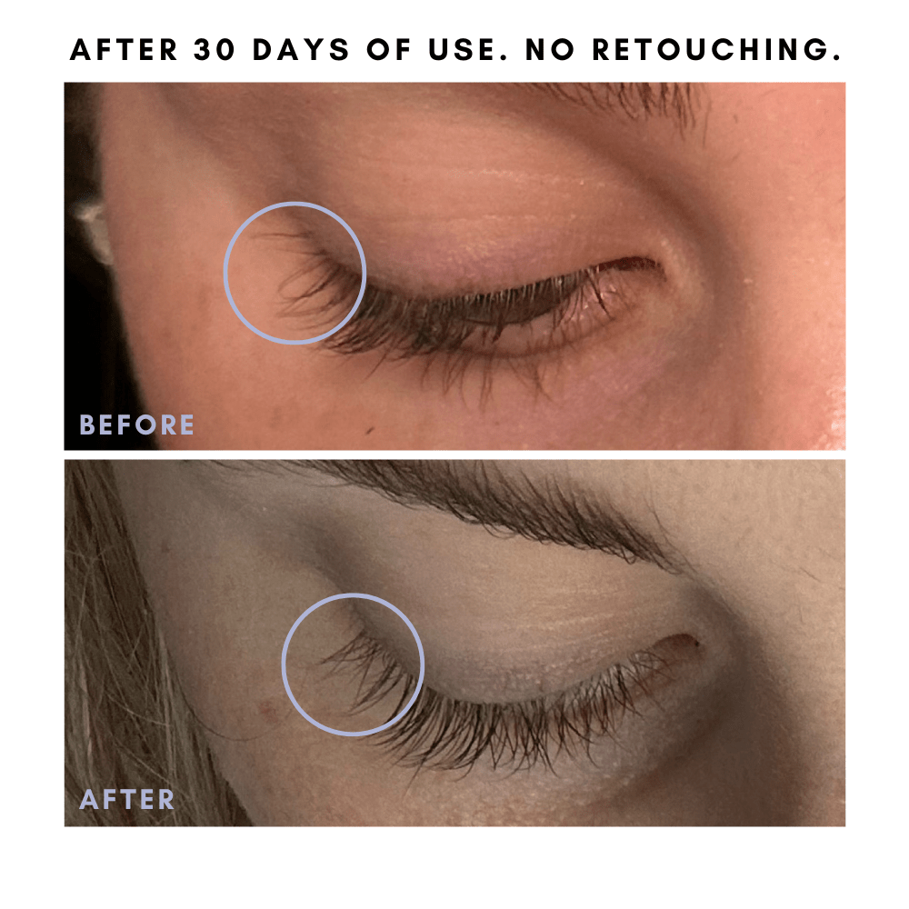 Full Of It Hair Growth Serum in - Skincare photo