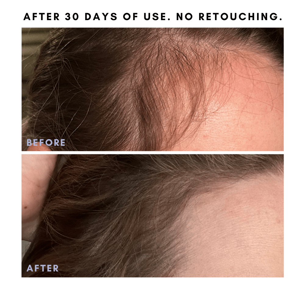 Full Of It Hair Growth Serum in - Skincare photo