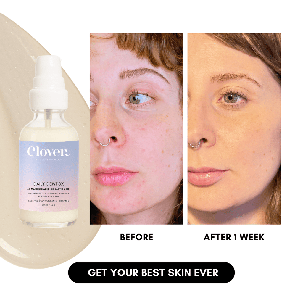 Daily Dewtox Smoothing & Brightening Essence in - Skincare photo