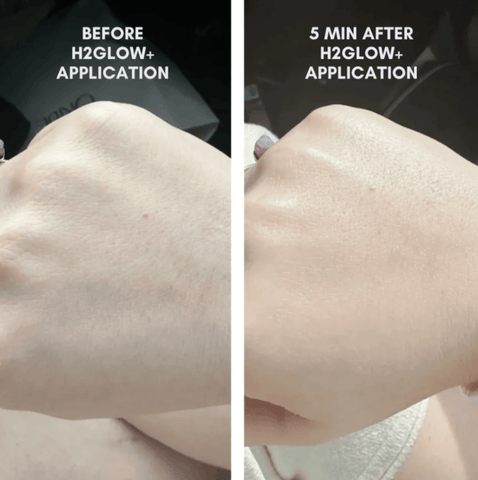 The Clear + Calm Skin Set | Acne + Skin Barrier Support Essentials -
