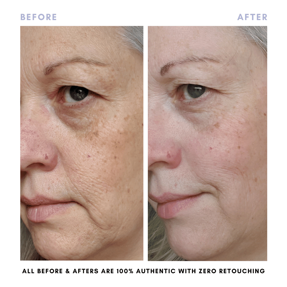 The Complete Skincare Collection in - Skincare photo