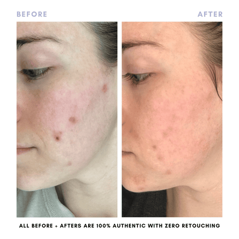 Clover by Clove + Harlow The Juicy Skin Special (+ FREE Rose Suds Cleanser) in - Skincare photo