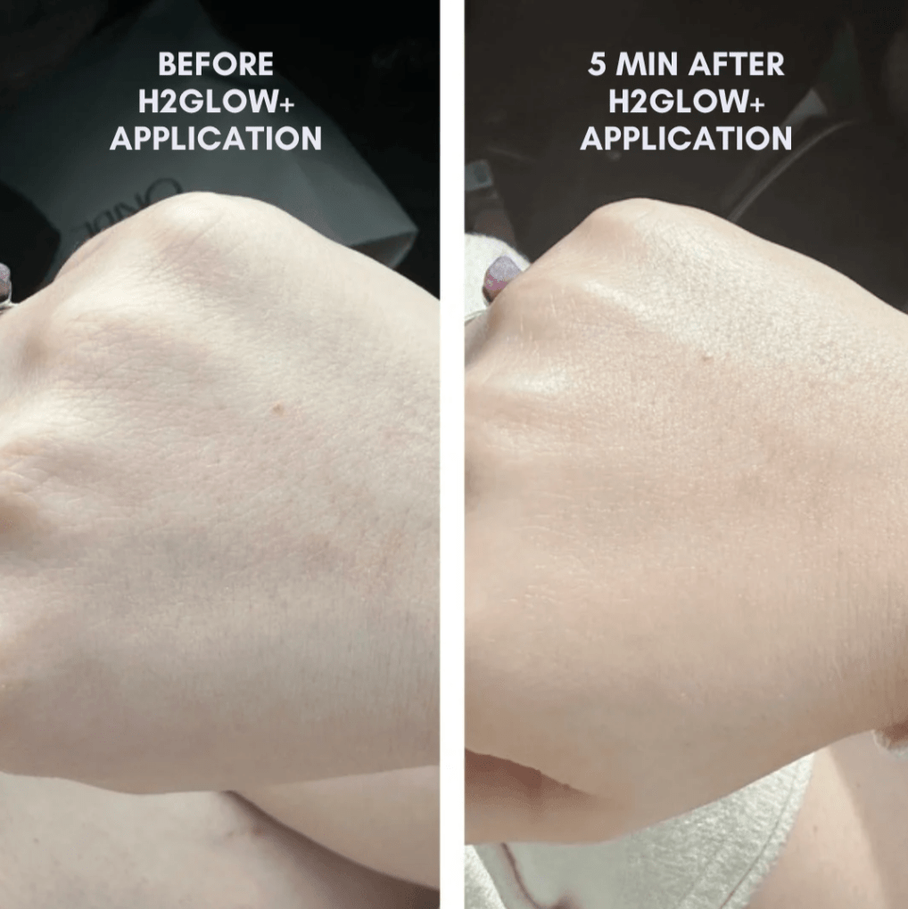 Clover by Clove + Harlow The Juicy Skin Special (+ FREE Rose Suds Cleanser) in - Skincare photo