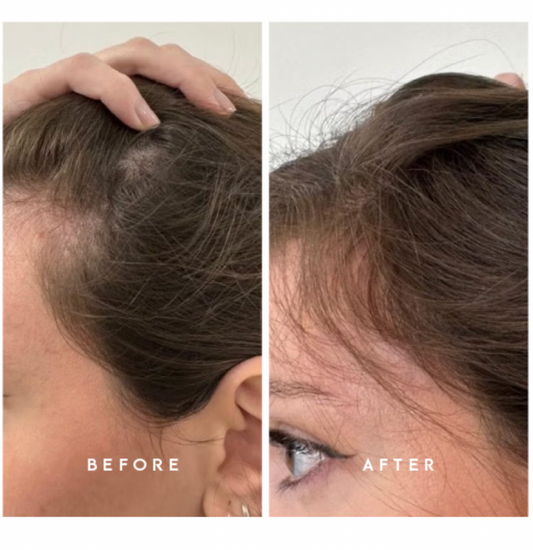 The Spoiled Mama Hair She Is Hair Growth Serum in - photo